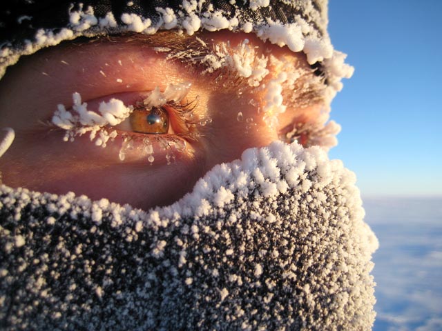 Person with frost on her face.