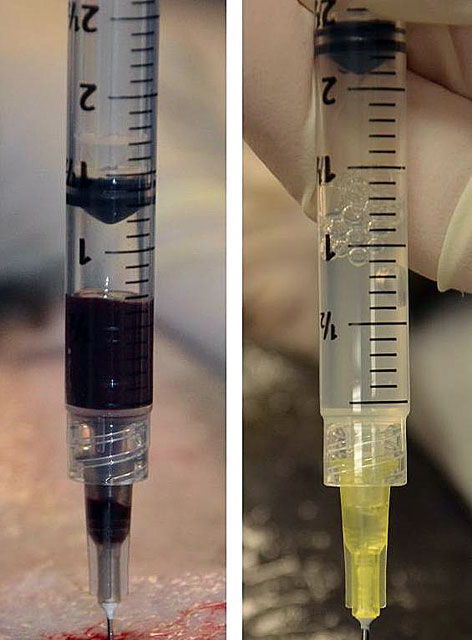 Two syringes with fish blood.