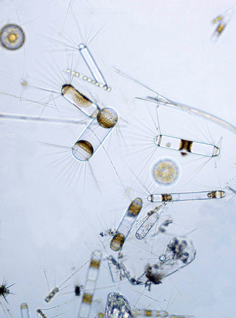 Phytoplankton under a microscope.
