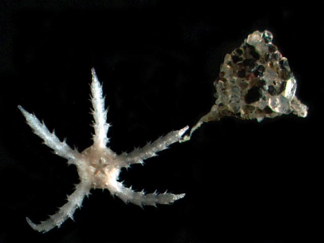 Juvenile starfish and foram.