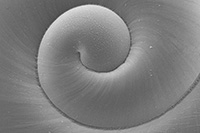 Under an electron microscope, the center of a healthy shell is smooth and even